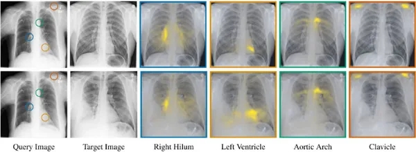 A collage of x-ray images of a person's chestAI-generated content may be incorrect.