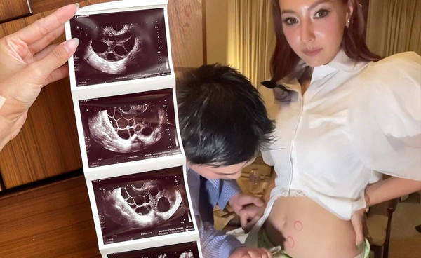 คารีสา น้ำตาไหล! บอกภูมิใจในตัวเอง เพื่อนๆแห่ยินดีหลังเห็นภาพอัลตราซาวด์