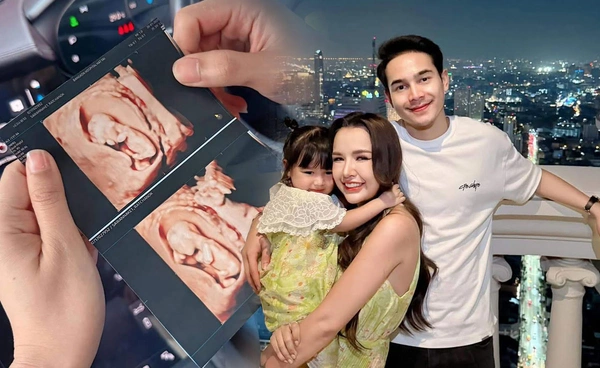 เจนนี่ รัชนก อวดภาพอัลตร้าซาวด์ ประกาศข่าวดีกำลังตั้งท้องลูกคนที่ 2