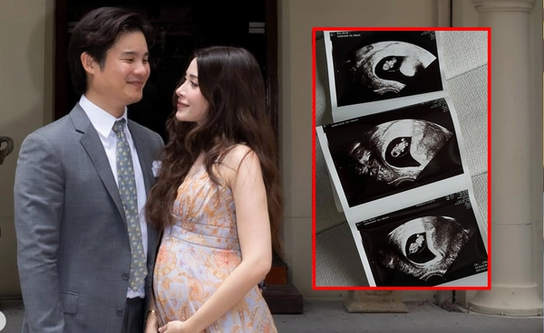 "นิโคล กิตติวัฒน์" ประกาศข่าวดี ตั้งท้องลูกคนแรก เตรียมตัวเป็นคุณแม่ 