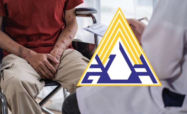 ประกันสังคม ย้ำผู้ประกันตนติดเชื้อ HIV–ผู้ป่วยเอดส์ รักษาตามสิทธิ ไม่เสียค่าใช้จ่าย