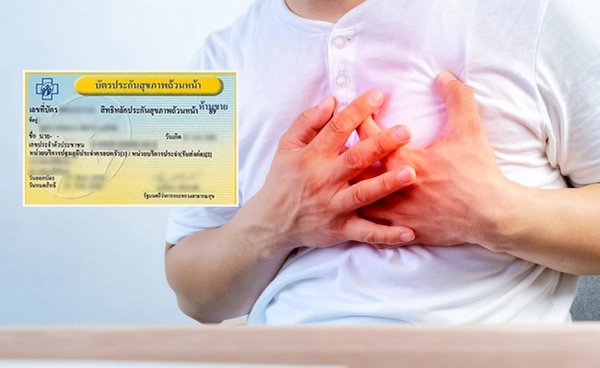 สิทธิบัตรทอง 30 บาท ครอบคลุม “โรคหลอดเลือดหัวใจ” ครบวงจร