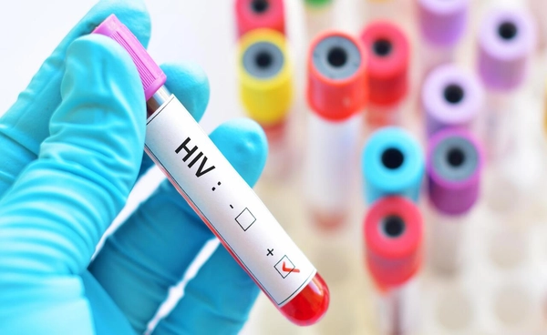 ปี 68 คนไทยติดเชื้อ "HIV" พุ่ง!เกินคาดการณ์ 1.5 เท่า และ 1 ใน 3 เป็นเยาวชนอายุ 15–24 ปี