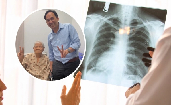 ผ่าตัด"มะเร็งปอด" ในวัย 94 ปี แพทย์ส่งต่อความหวังให้ผู้ป่วย สำเร็จ! เผยเคล็ดลับช่วยให้ฟื้นตัวไว ไม่ต้องนอน รพ.นาน