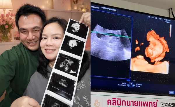 "สมปอง นครไฉไล" ประกาศข่าวดี ภรรยาตั้งครรภ์ลูกคนแรก