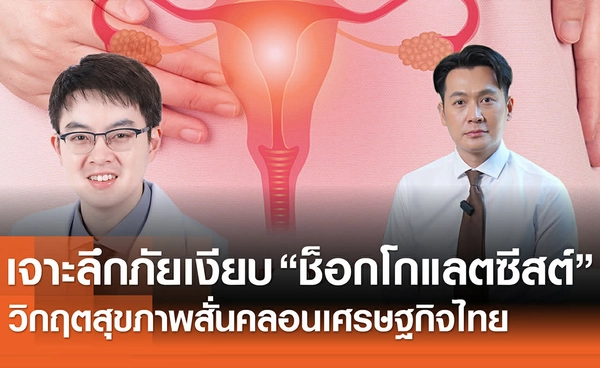 เจาะลึกภัยเงียบ "ช็อกโกแลตซีสต์" วิกฤติสุขภาพสั่นคลอนเศรษฐกิจไทย