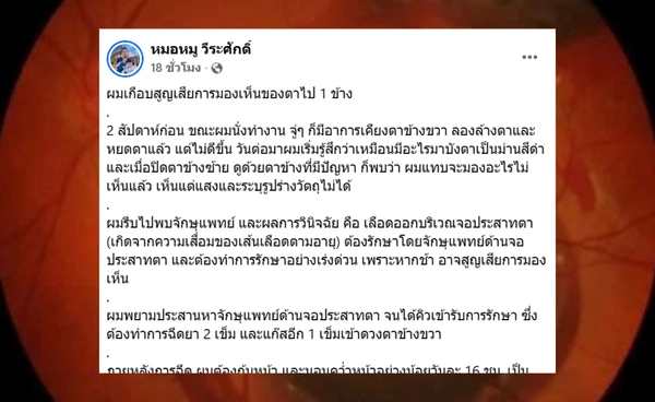 หวิดตาบอด หมอหมู เล่าประสบการณ์ แนะดวงตามีปัญหา รีบไปพบแพทย์