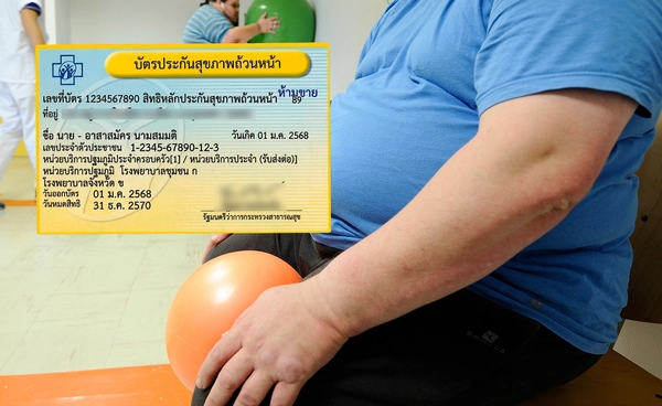 บัตรทอง 30 บาท เพิ่มสิทธิรักษาโรคอ้วน! ครอบคลุมผ่าตัดลดน้ำหนัก