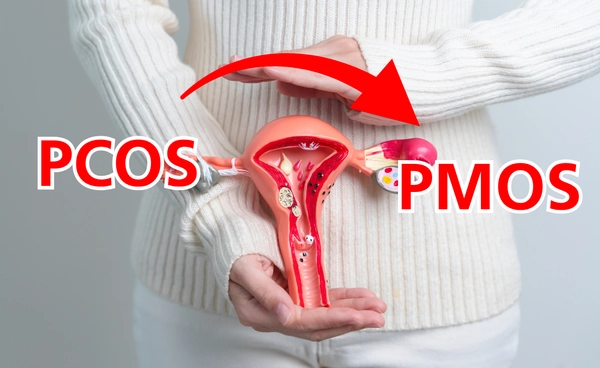 PCOS กำลังเปลี่ยนชื่อเป็น PMOS เพื่อความเข้าใจเกี่ยวกับโรคที่ถูกต้องมากขึ้น