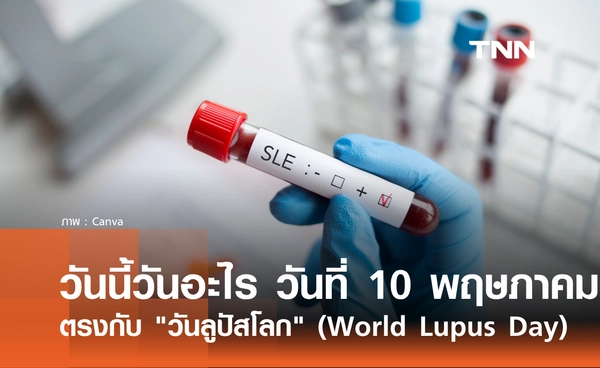 วันนี้วันอะไร 10 พฤษภาคม 2569 ตรงกับ "วันลูปัสโลก" (World Lupus Day)
