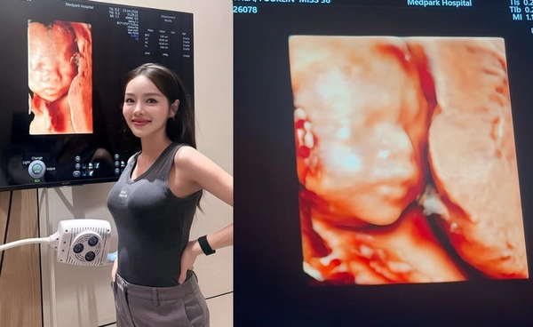"แอร์ ภัณฑิลา" อัปเดตท้องลูกคนที่ 2 เข้าเดือน 5 แล้ว