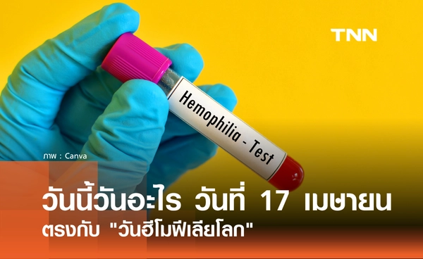 วันนี้วันอะไร วันที่ 17 เมษายน 2569 ตรงกับ "วันฮีโมฟีเลียโลก" (World Hemophilia Day)