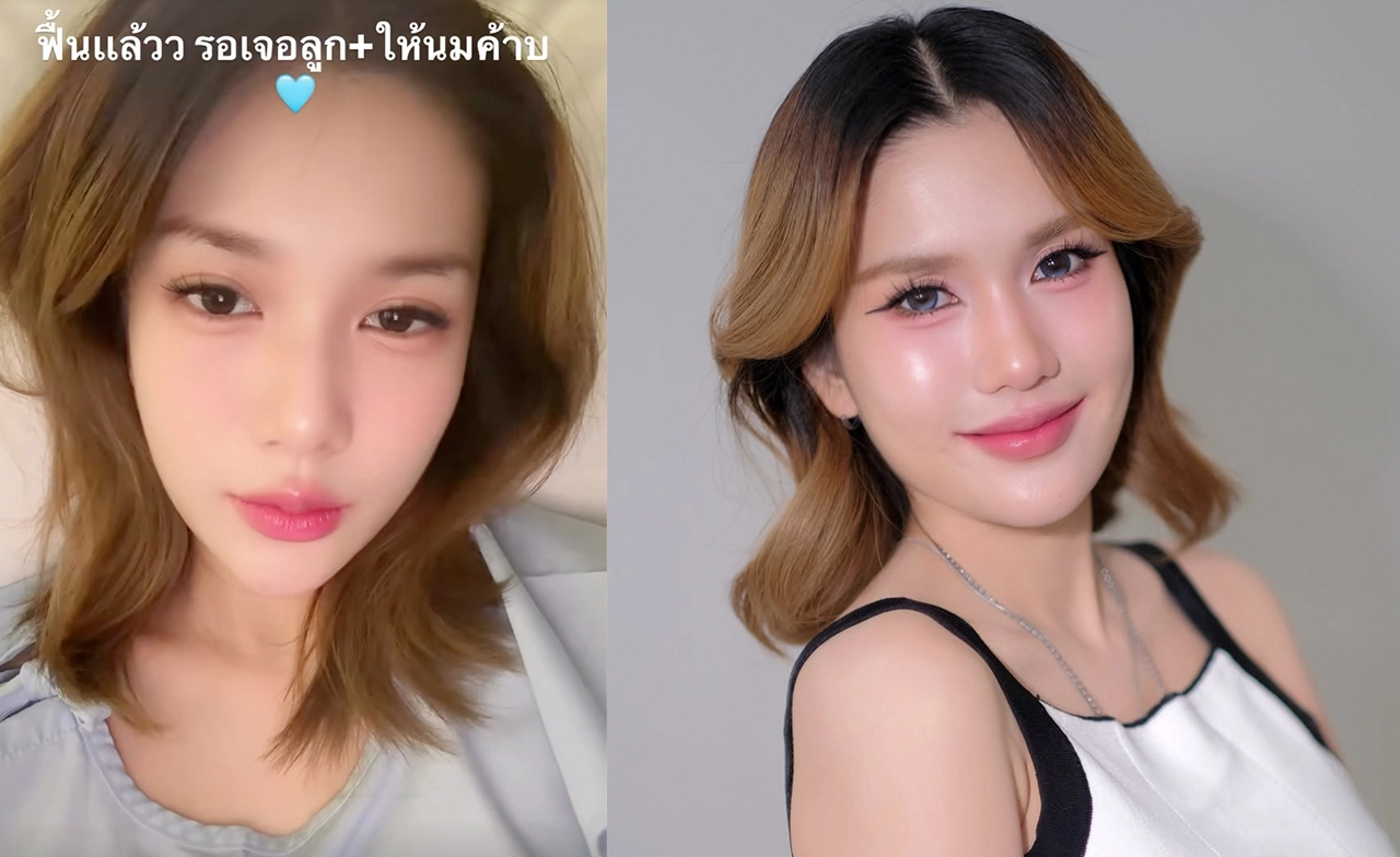 “ฟารีดา” คลอด “น้องเวร่า” ก่อนกำหนด เผยหน้าเหมือนพ่อ “ติณติณ” 100%