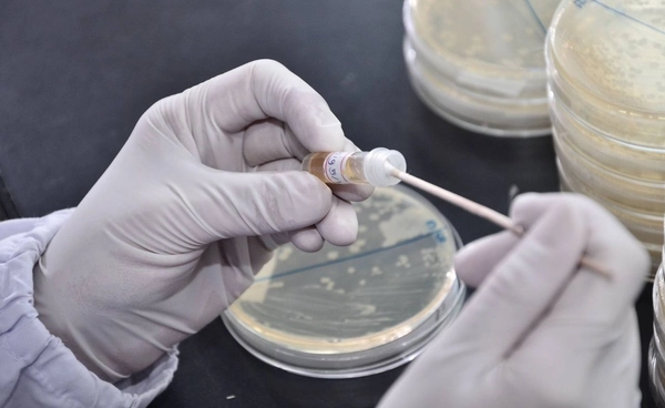 กรมวิทย์ฯ เตือนระวังเชื้อ Streptococcus suis หลังพบแนวโน้มผู้ป่วยเพิ่มขึ้น