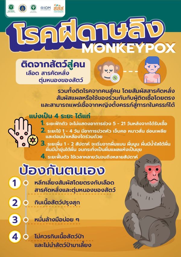 ฝีดาษลิง เปิด 5 วิธีดูแล-ป้องกันตัวเองง่ายๆให้ห่างไกลจากโรค