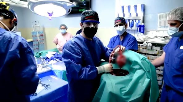 ครั้งแรกของโลก! แพทย์มะกันผ่าตัดปลูกถ่าย หัวใจหมู ในมนุษย์สำเร็จ