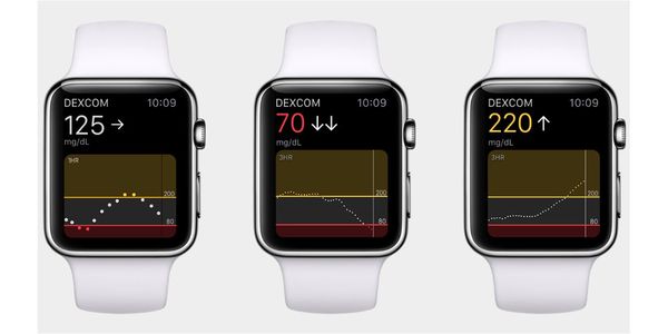 Apple Watch รุ่นใหม่ อาจมาพร้อมเซนเซอร์วัดระดับน้ำตาลในเลือด