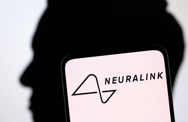 Neuralink เริ่มการทดลองปลูกถ่ายชิปลงในสมองมนุษย์ หวังฟื้นผู้ป่วยอัมพาต