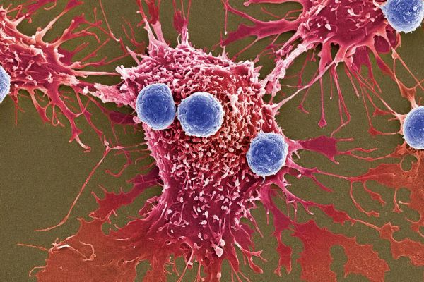 ไวรัสกำจัดมะเร็งระยะลุกลาม เริ่มนำมาใช้รักษาในมนุษย์เป็นครั้งแรกแล้ว !!