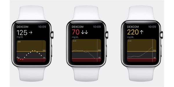 Apple Watch Series 7 อาจมาพร้อมเซนเซอร์วัดระดับน้ำตาลในเลือด