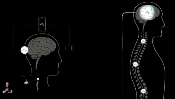 FDA อนุมัติ Neuralink ฝังชิปลงสมองทดลองกับมนุษย์ครั้งแรก