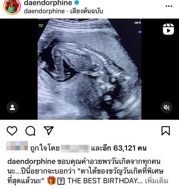 ดา เอ็นโดรฟิน เผยความรู้สึก หลังตั้งท้องลูกคนแรกได้ 4 เดือน 