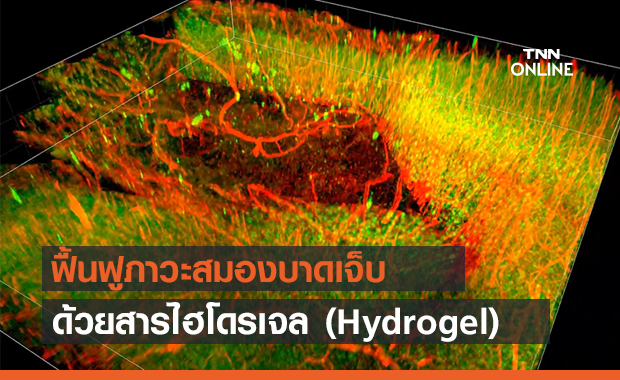 นักวิจัยค้นพบวิธีฟื้นฟูสมองบาดเจ็บ ด้วยไฮโดรเจล (Hydrogel)