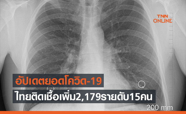 ไทยยังอ่วมโควิด! เสียชีวิตนิวไฮ  15 คน ติดเชื้อเพิ่มวันนี้ 2,179 ราย