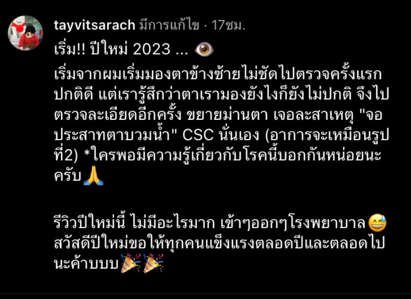  เต้ วิทย์สรัช ป่วยรับปีใหม่ เป็นโรค CSC จอประสาทตาบวม 