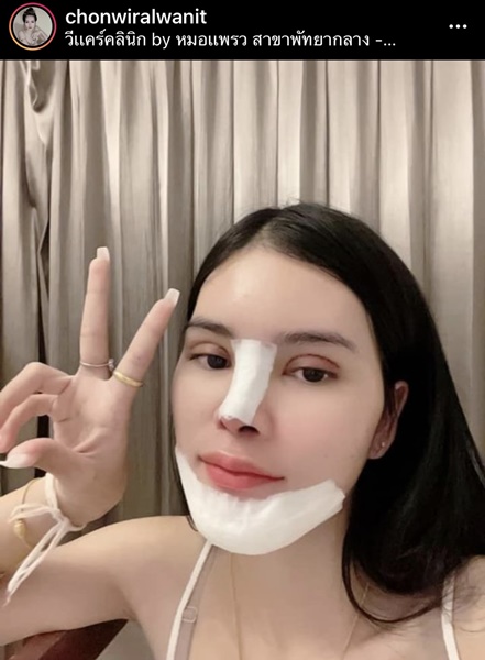 เอ๋ มิรา อัพความสวย ศัลยกรรมจมูก ตา และคาง 