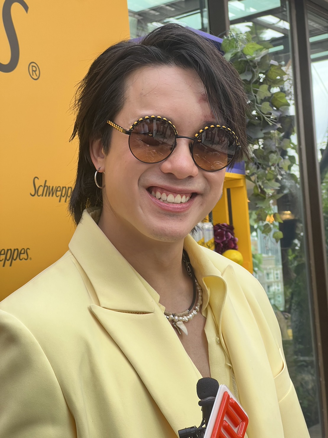 เจมส์ ธีรดนย์ ไม่กังวลหน้าเป็นแผลใหญ่ รับช่วงนี้น้ำหนักเพิ่ม