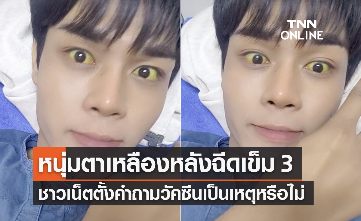 หนุ่มโพสต์ "ตาเหลือง" หลังฉีดเข็ม 3 ชาวเน็ตตั้งคำถามเพราะวัคซีนหรือไม่?