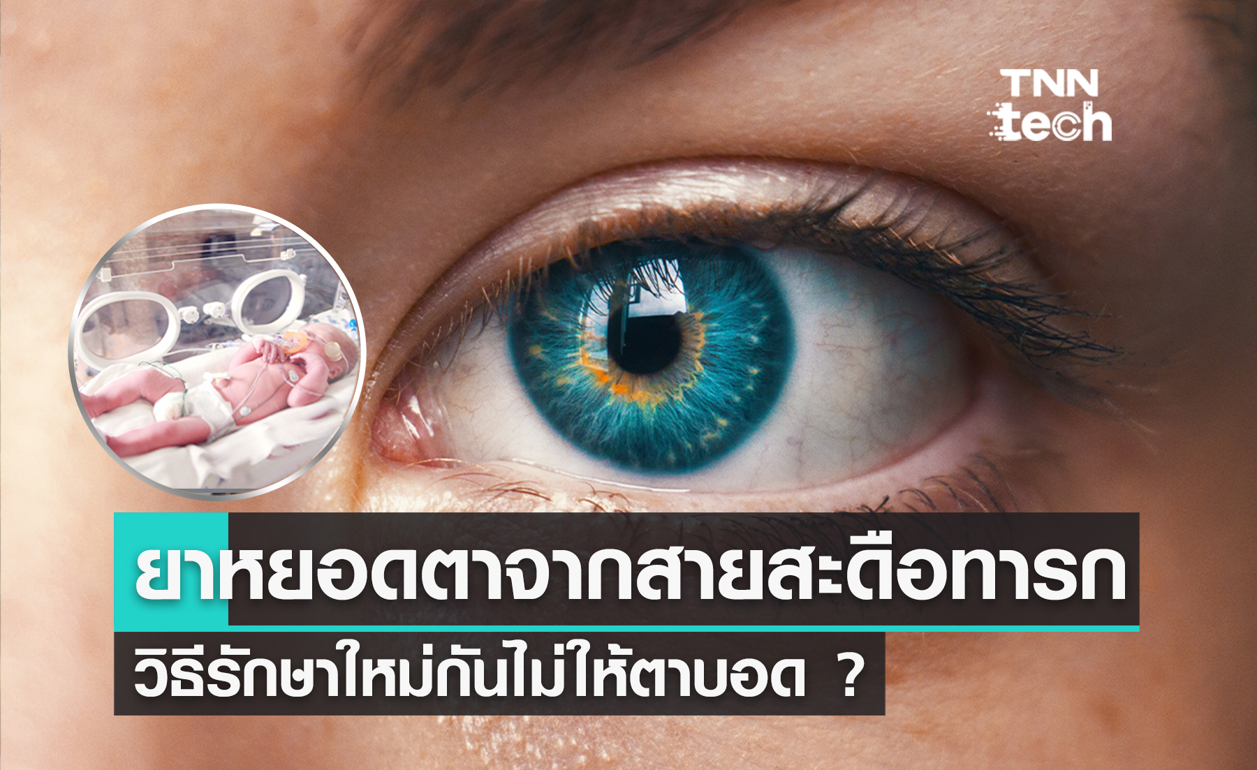 ยาหยอดตาจากสายสะดือทารก วิธีใหม่ป้องกันไม่ให้ตาบอด ?