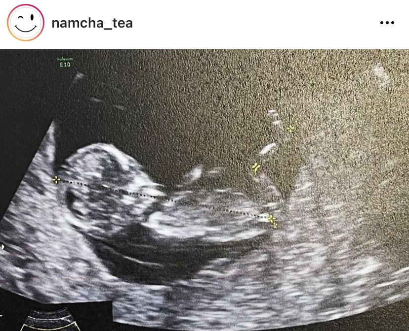 น้ำชา ประกาศข่าวดี ตั้งครรภ์ลูกคนแรกแล้ว น้ำชา ประกาศข่าวดี ตั้งครรภ์ลูกคนแรกแล้ว