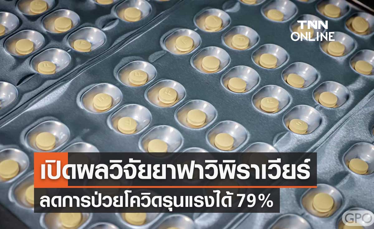 สธ.เปิดผลวิจัยประสิทธิภาพ "ยาฟาวิพิราเวียร์" ลดอาการป่วยโควิดรุนแรง 79%