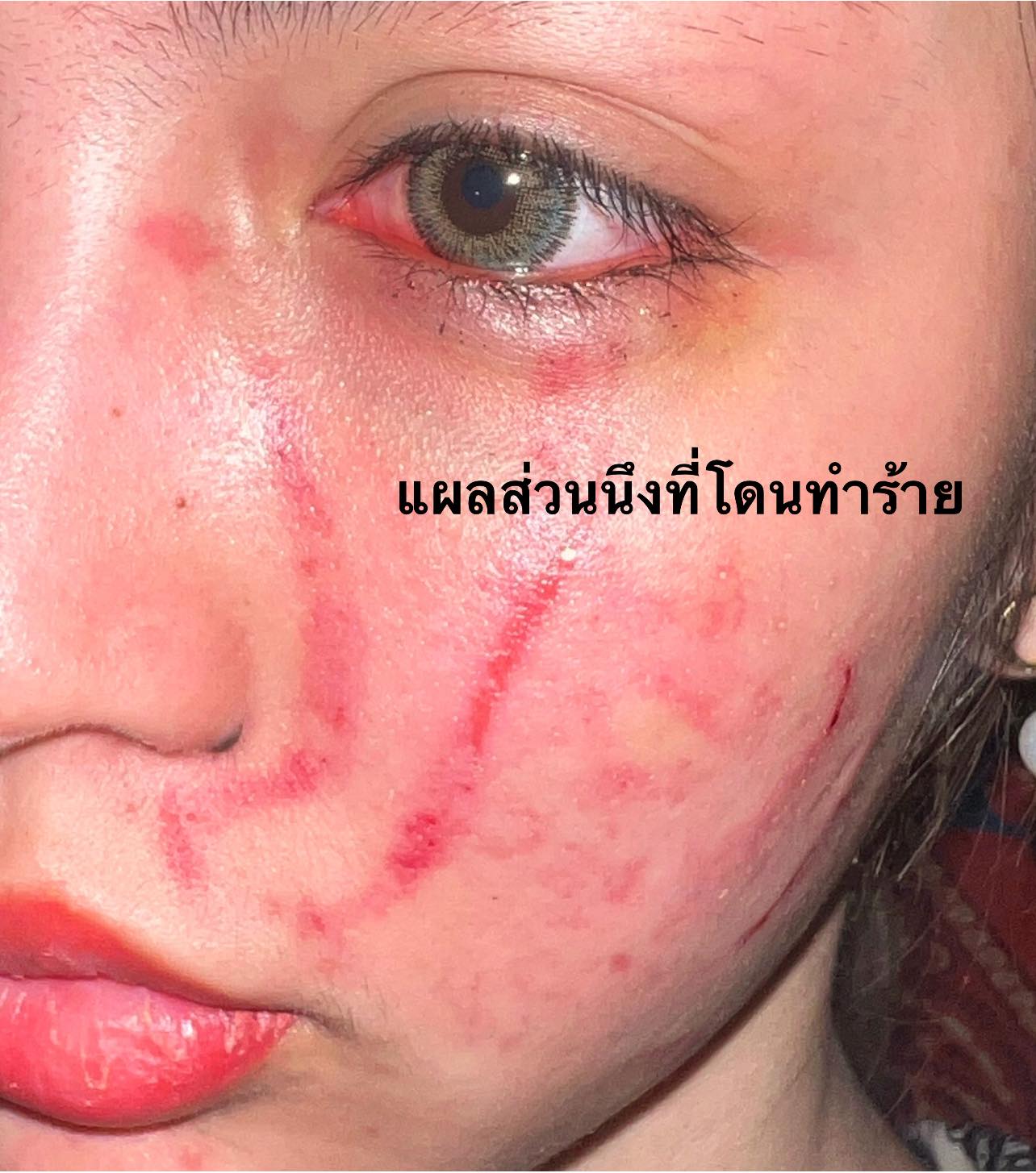 โนอา ภญมณ เข้าพบตำรวจมอบหลักฐานเพิ่มเติม หลังถูกทำร้ายร่างกาย โนอา ภญมณ เข้าพบตำรวจมอบหลักฐานเพิ่มเติม หลังถูกทำร้ายร่างกาย
