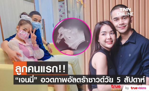 "เจนนี่ รัชนก" เผยภาพอัลตร้าซาวด์ลูกคนแรก