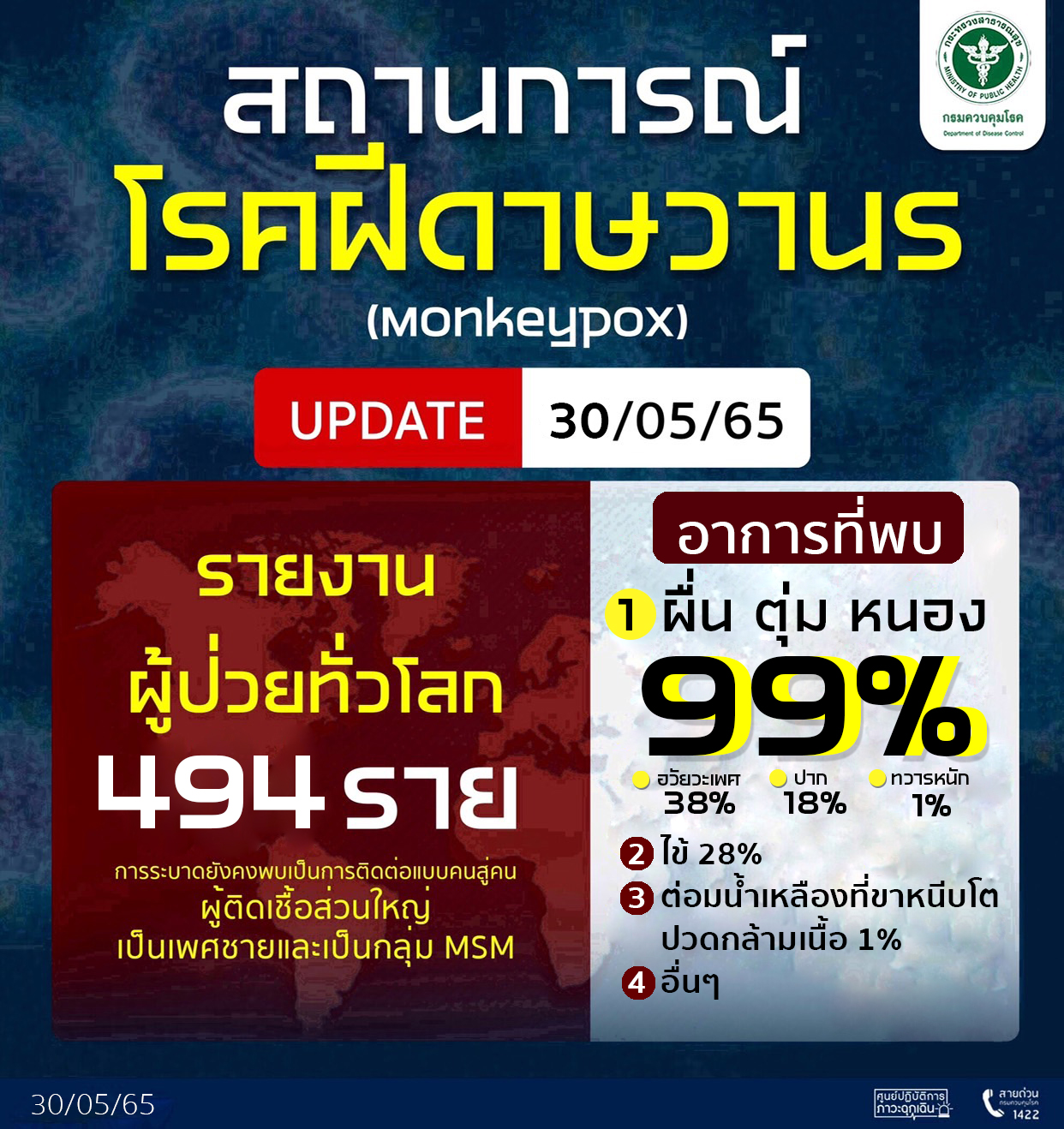 ยืนยันไทยยังไม่พบผู้ป่วยโรคฝีดาษลิง ติดตาม 12 รายใกล้ชิดผู้ป่วยระหว่าเดินทาง ยังปลอดภัย ยืนยันไทยยังไม่พบผู้ป่วยโรคฝีดาษลิง ติดตาม 12 รายใกล้ชิดผู้ป่วยระหว่าเดินทาง ยังปลอดภัย