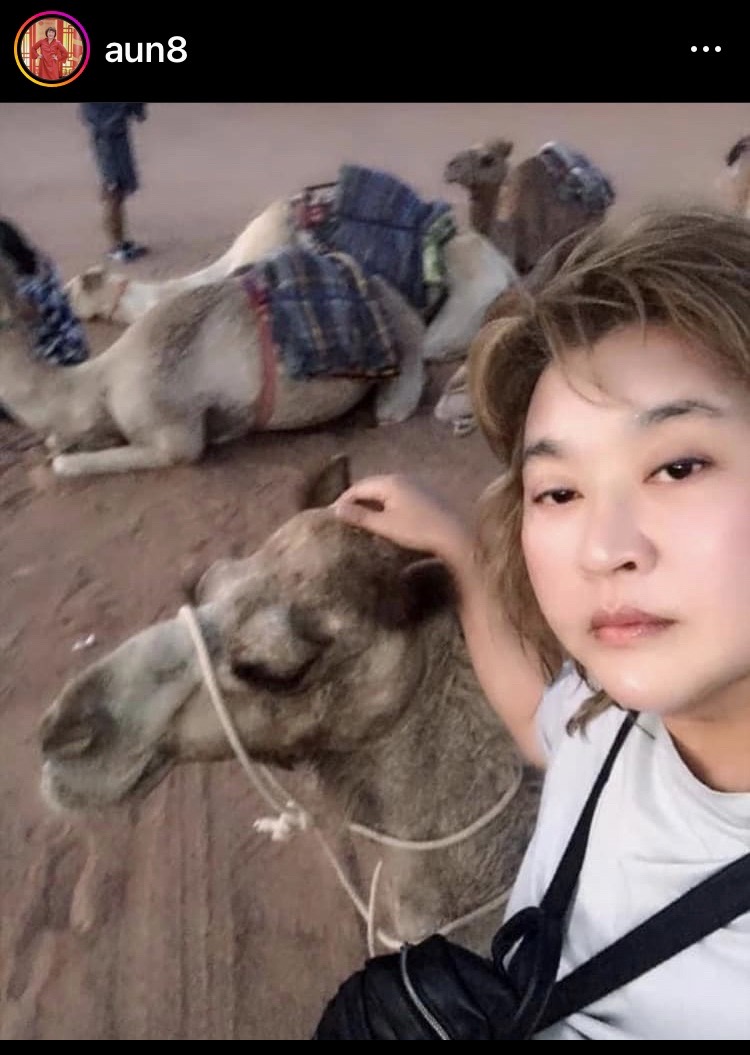 “อ้วน รีเทิร์น” เผยแผลที่มือดีขึ้นแล้ว หลังวิดหนีอูฐที่ประเทศโอมาน “อ้วน รีเทิร์น” เผยแผลที่มือดีขึ้นแล้ว หลังวิดหนีอูฐที่ประเทศโอมาน