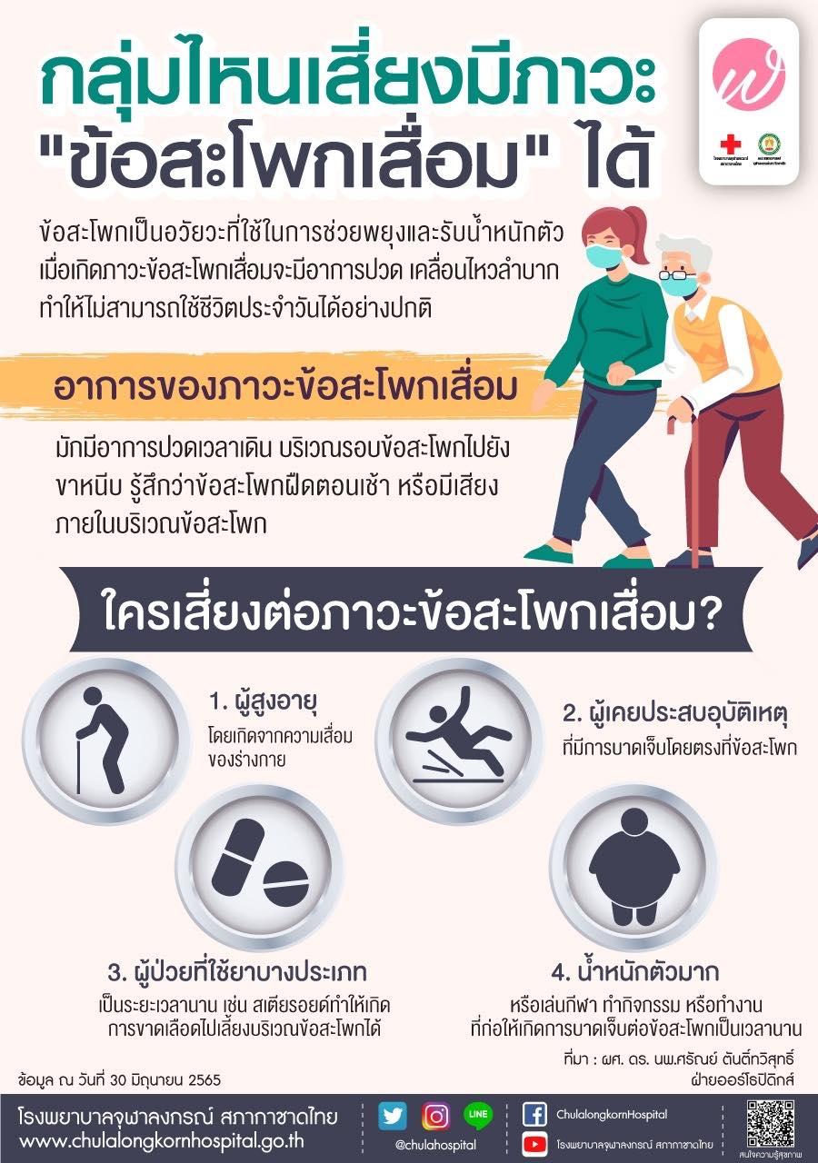 เช็กตัวเองเข้าข่าย 4 กลุ่ม‘ภาวะข้อสะโพกเสื่อม’ หรือไม่ 
