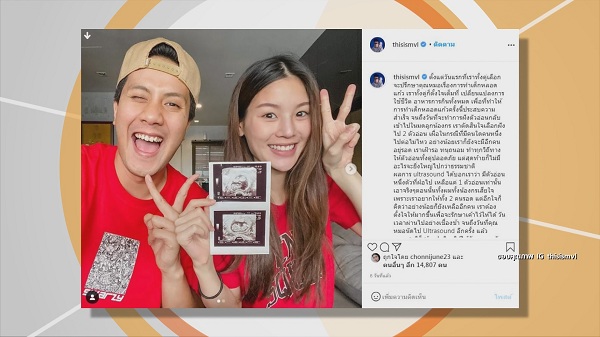 “เป้ วงมายด์”  แฮปปี้ ได้ลูกแฝด จากนี้ลุ้นเพศลูก (มีคลิป)