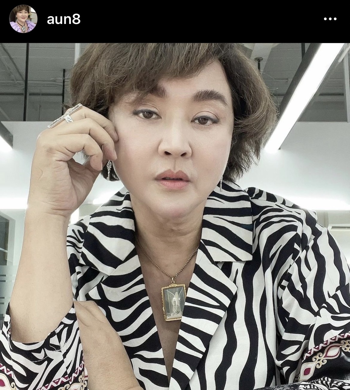 จัดชุดใหญ่!! อ้วน รีเทิร์น ผ่าตัดเหนียง เสริมความงาม จัดชุดใหญ่!! อ้วน รีเทิร์น ผ่าตัดเหนียง เสริมความงาม