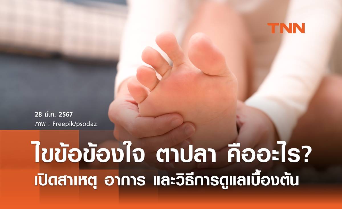 ไขข้อข้องใจ "ตาปลา" คืออะไร เปิดสาเหตุ อาการ และวิธีการดูแลเบื้องต้น