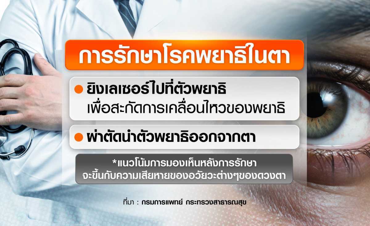 ฉลองปีใหม่ กินของแปลก ระวังตาบอด ฉลองปีใหม่ กินของแปลก ระวังตาบอด