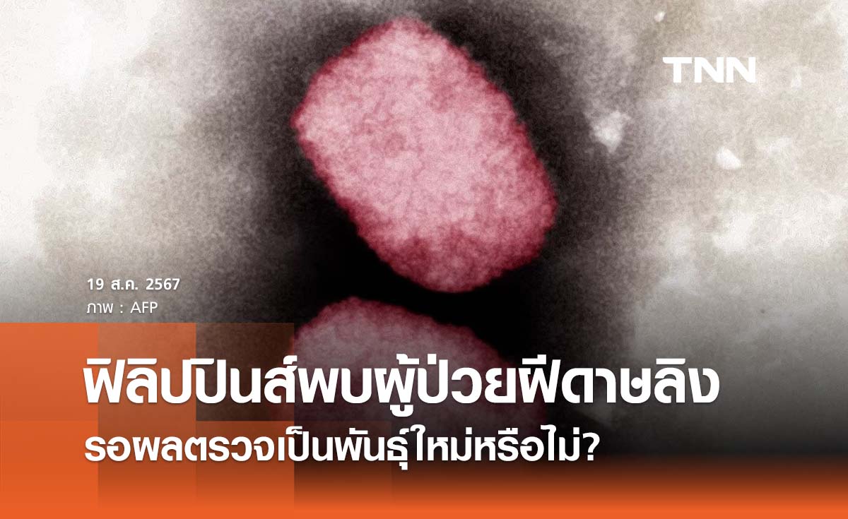 ฟิลิปปินส์พบผู้ป่วยฝีดาษลิงในประเทศ รอผลตรวจเป็นพันธุ์ใหม่หรือไม่?