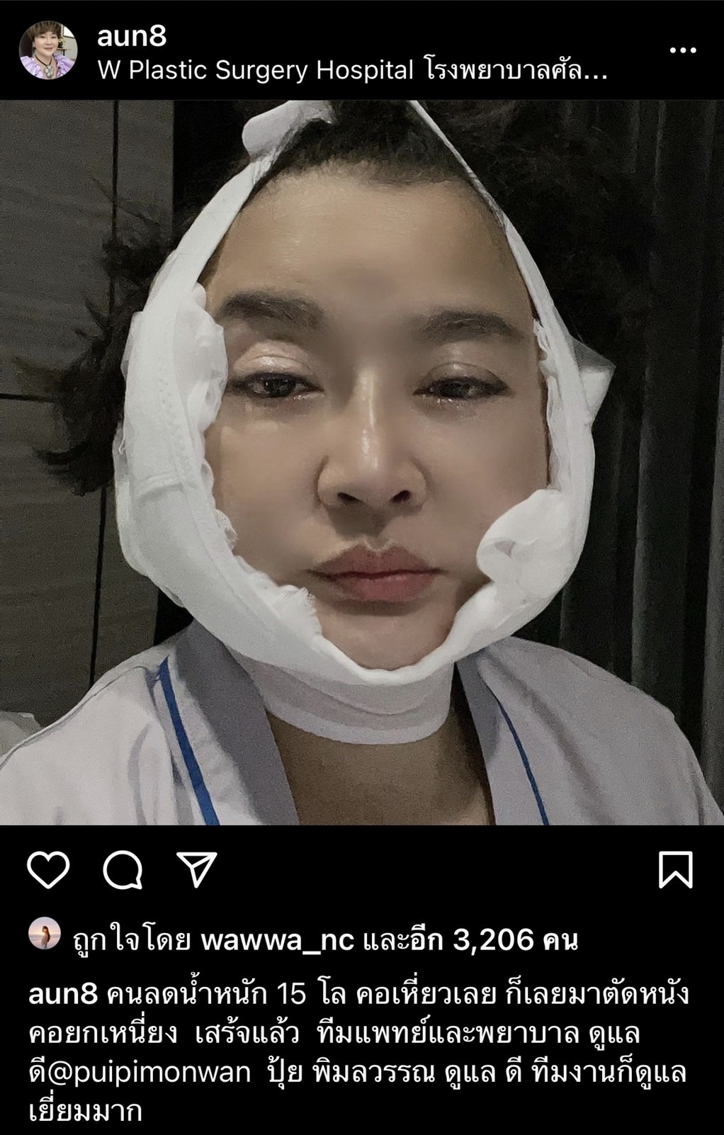 จัดชุดใหญ่!! อ้วน รีเทิร์น ผ่าตัดเหนียง เสริมความงาม จัดชุดใหญ่!! อ้วน รีเทิร์น ผ่าตัดเหนียง เสริมความงาม