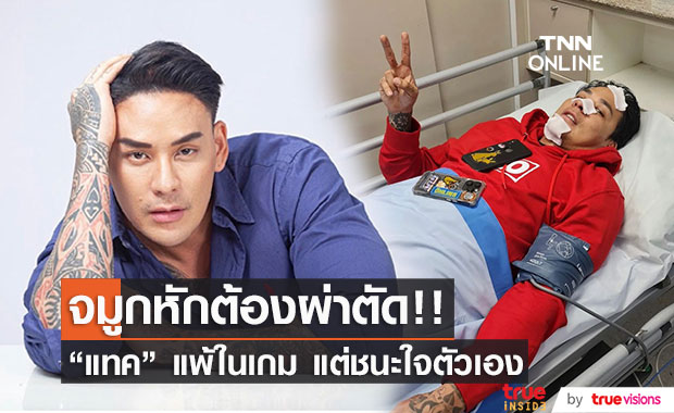“แทค ภรัณยู” จมูกหัก! หลังถูก “เนท My Mate Nate” สวนหมัดเข้าเต็มหน้า