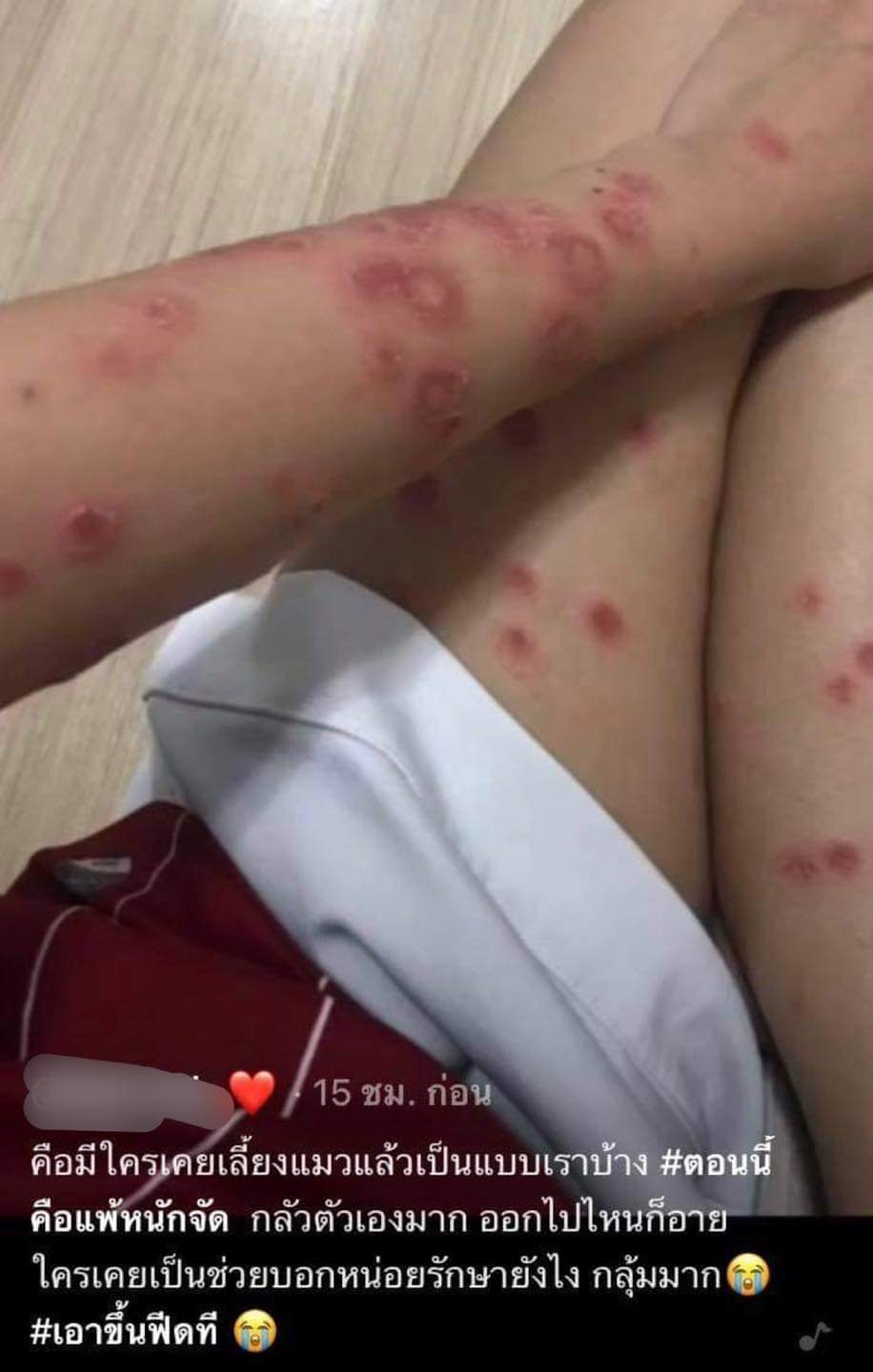 เปิดวิธีเยียวยาทาสแมวหลังติด ‘เชื้อราแมว’ โรคของคนรักสัตว์ เปิดวิธีเยียวยาทาสแมวหลังติด ‘เชื้อราแมว’ โรคของคนรักสัตว์