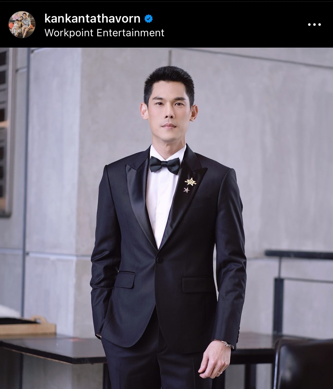 ไม่ต้องตกใจ กันต์ กันตถาวร ภาพรอยช้ำที่แขน ยันไม่ได้ทะเลาะกับเมีย