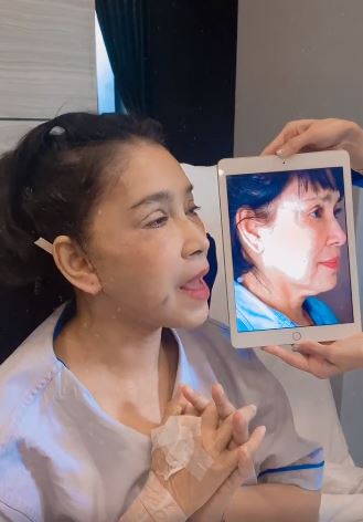 สวยสะพรั่ง!! แอ๊ว อำภา ทำหน้าใหม่ ตัดเหนียงดูสาวกว่าเดิม
